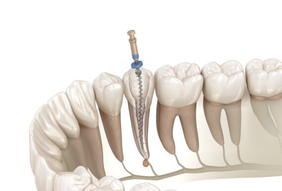 Endodonzia