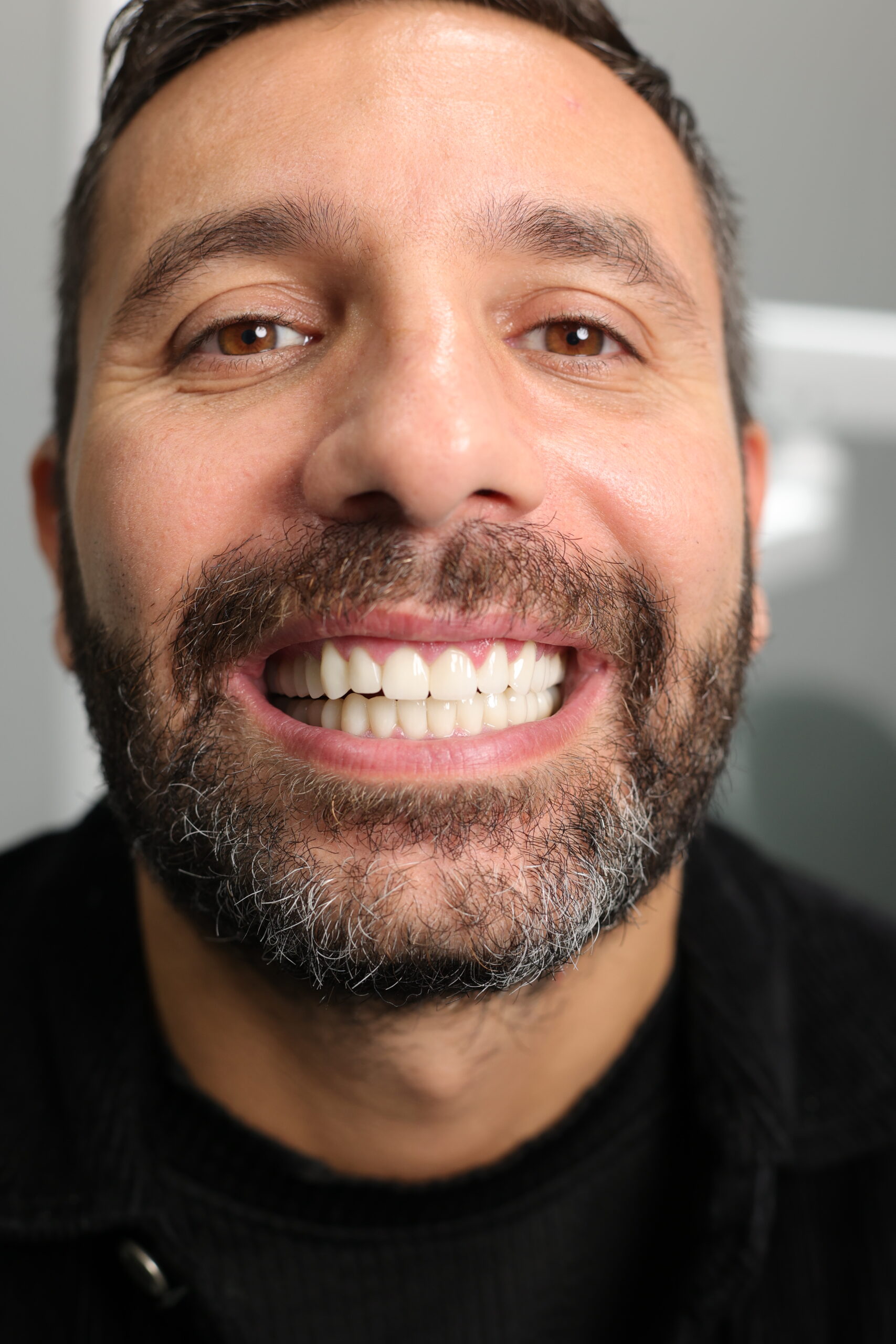 https://dentadent.al/wp-content/uploads/2025/01/SULA7781-scaled.jpg