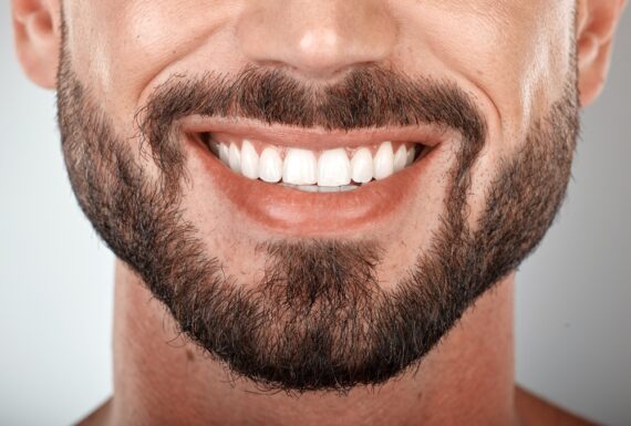 Estetica Dentale
